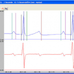 PONEMAH生理信号分析软件