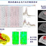 “诺凯德” EEG认知神经评估及反馈系统